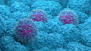 Revolution Medicines胰腺癌药物在晚期试验中获得成功