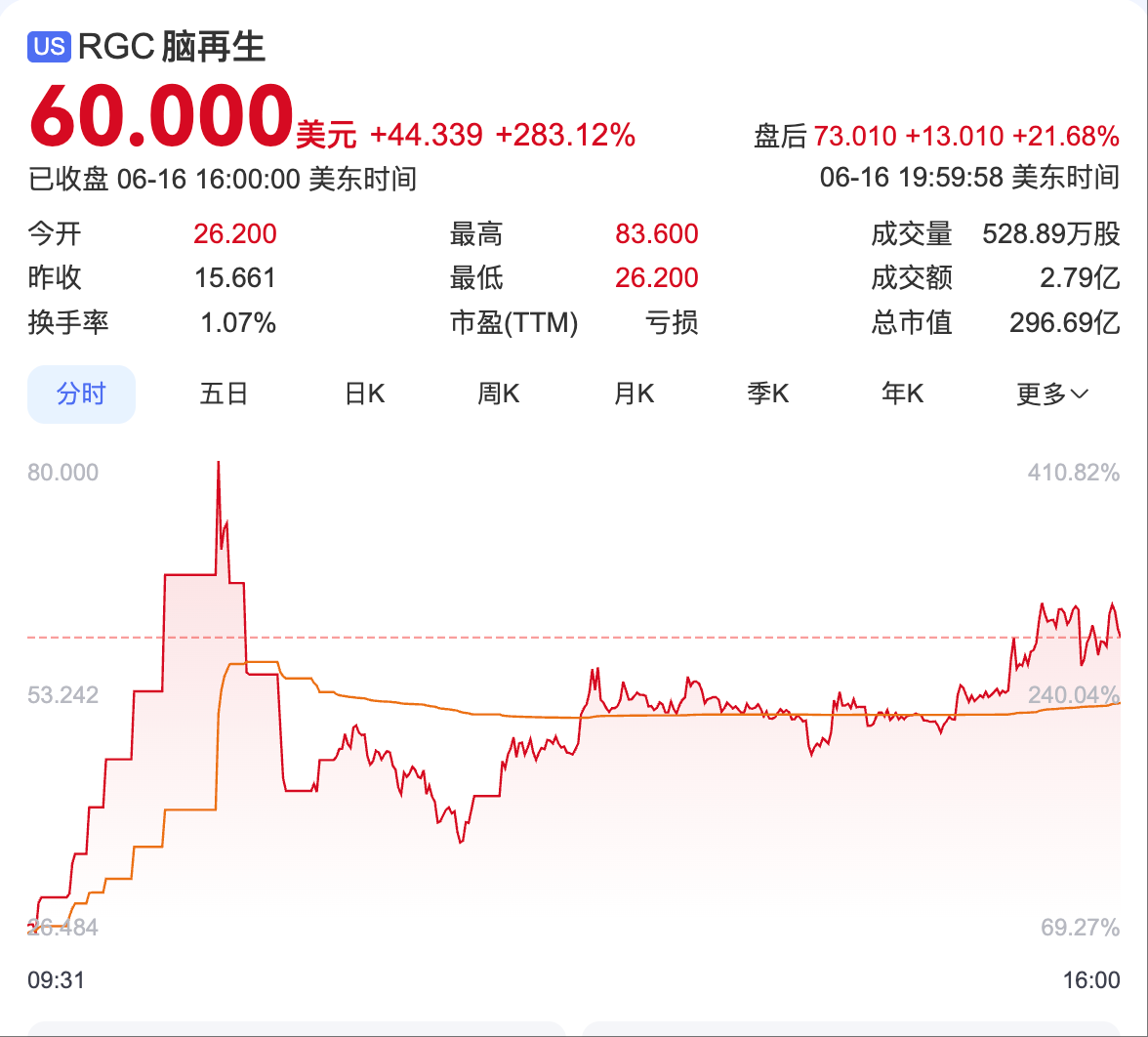 美股脑再生科技股价暴涨283%,港股、A股脑机接口概念股同步狂欢 第1张 美股脑再生科技股价暴涨283%,港股、A股脑机接口概念股同步狂欢 第1张
